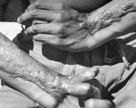 广岛核爆威力到底有多大 现场又是怎么样的