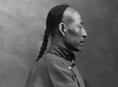 清朝规定男性都要留辫子，那秃顶和光头的人怎么办