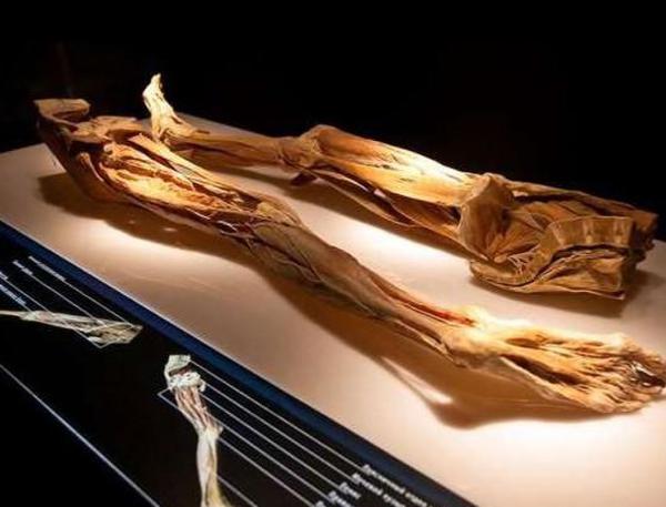 俄罗斯恐怖人体标本展