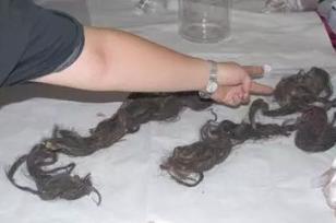 光绪死于砒霜中毒，溥仪认为袁世凯是凶手！