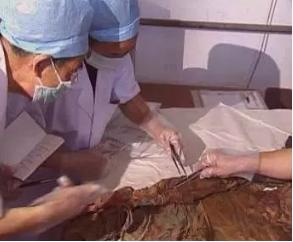 光绪死于砒霜中毒，溥仪认为袁世凯是凶手！