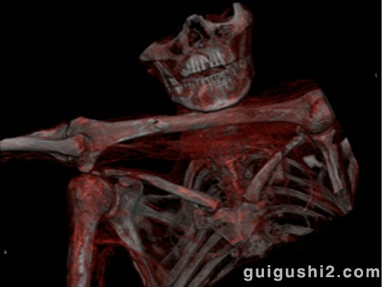 神秘冰人发现揭秘