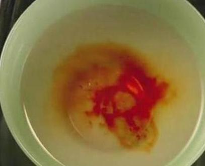 古时候的滴血认亲靠谱吗 这种方法有科学依据吗