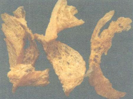 张石顽著有哪些医学理论